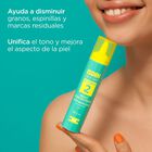 Isdin Acniben 2 Anti-Imperfecciones - Frasco 27 ML, , large image number null